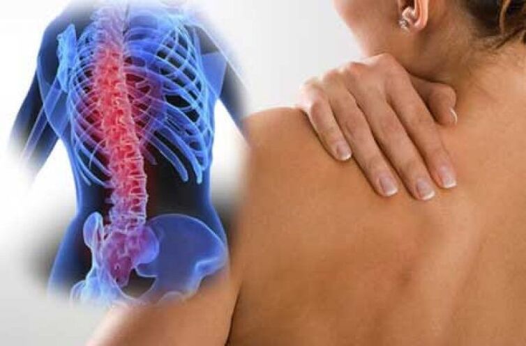 Me osteokondrozën, dhimbja mund të përhapet në pjesë të largëta të trupit