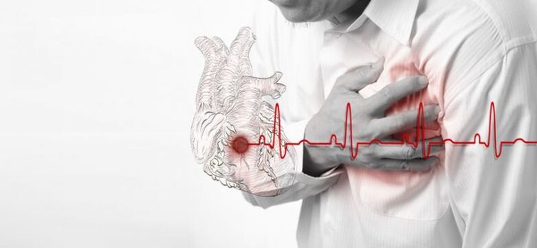 infarkti si shkaktar i dhimbjes nën shpatullën e majtë