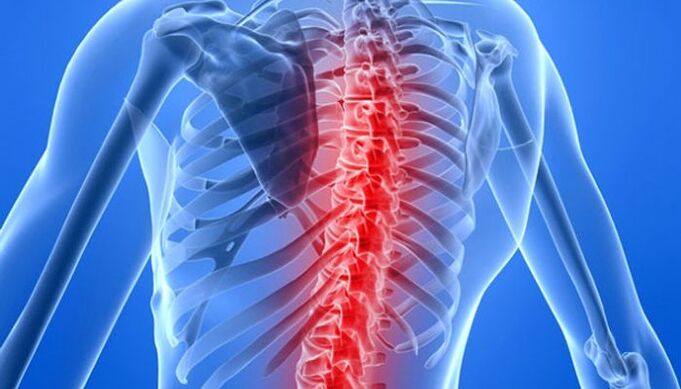 Patologjitë e shtyllës kurrizore janë shkaqet më të zakonshme të dhimbjes së shpinës në zonën e shpatullave