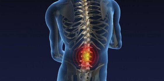 departament lumbar