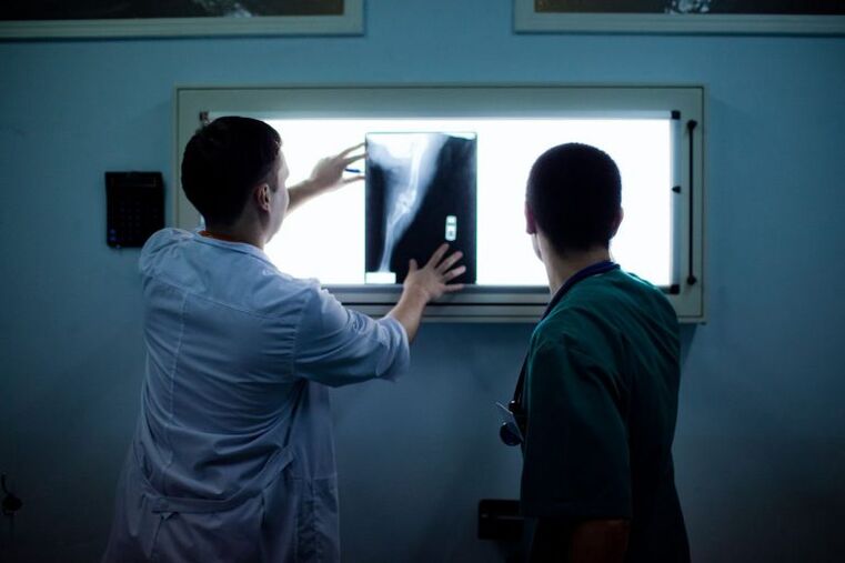 Diagnoza e artrozës në x -ray