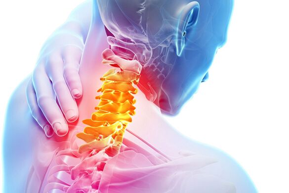 Osteokondroza e qafës së mitrës