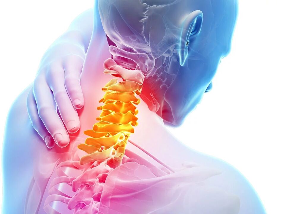 Osteokondroza e qafës së mitrës