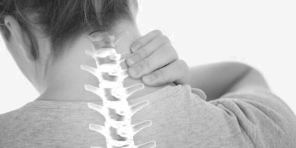 Osteokondroza e shtyllës kurrizore të qafës së mitrës - patologji e sistemit muskuloskeletor