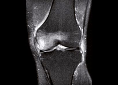 diagnostifikimit